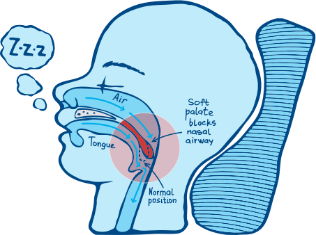 Healthy Lungs and Clear Airway Diagram
